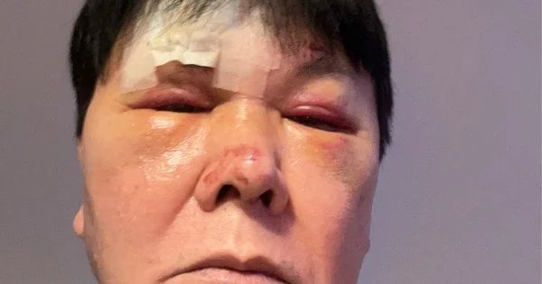 Voice Actor Yūji Mitsuya Hospitalized Following Injury – News Voice Actor Yūji Mitsuya Hospitalized Following Injury - News